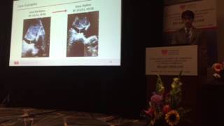 Dr. Devin Kehl - POC ultrasound - IVC and atrial fibrillation