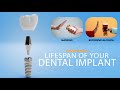 Dental implant treatment (DR.Sudhakara Reddy)