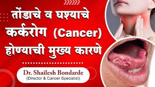 All You Have To Know About 'Oral Cancer' Causes, Symptoms & Recent Advances Of Treatment.