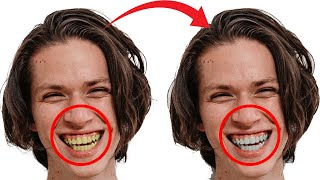 best way to whiten teeth in photoshop #shorts