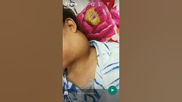 KANKER NASOFARING : GEJALA, PENYEBAB, DAN PENGOBATANYA  #INFO SELENGKAPNYA :  #Hub. KLINIK ALTERNATI