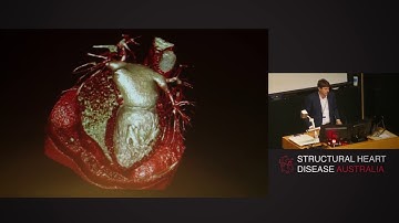 Cardiovascular 3D printing and simulation - Dr James Otton