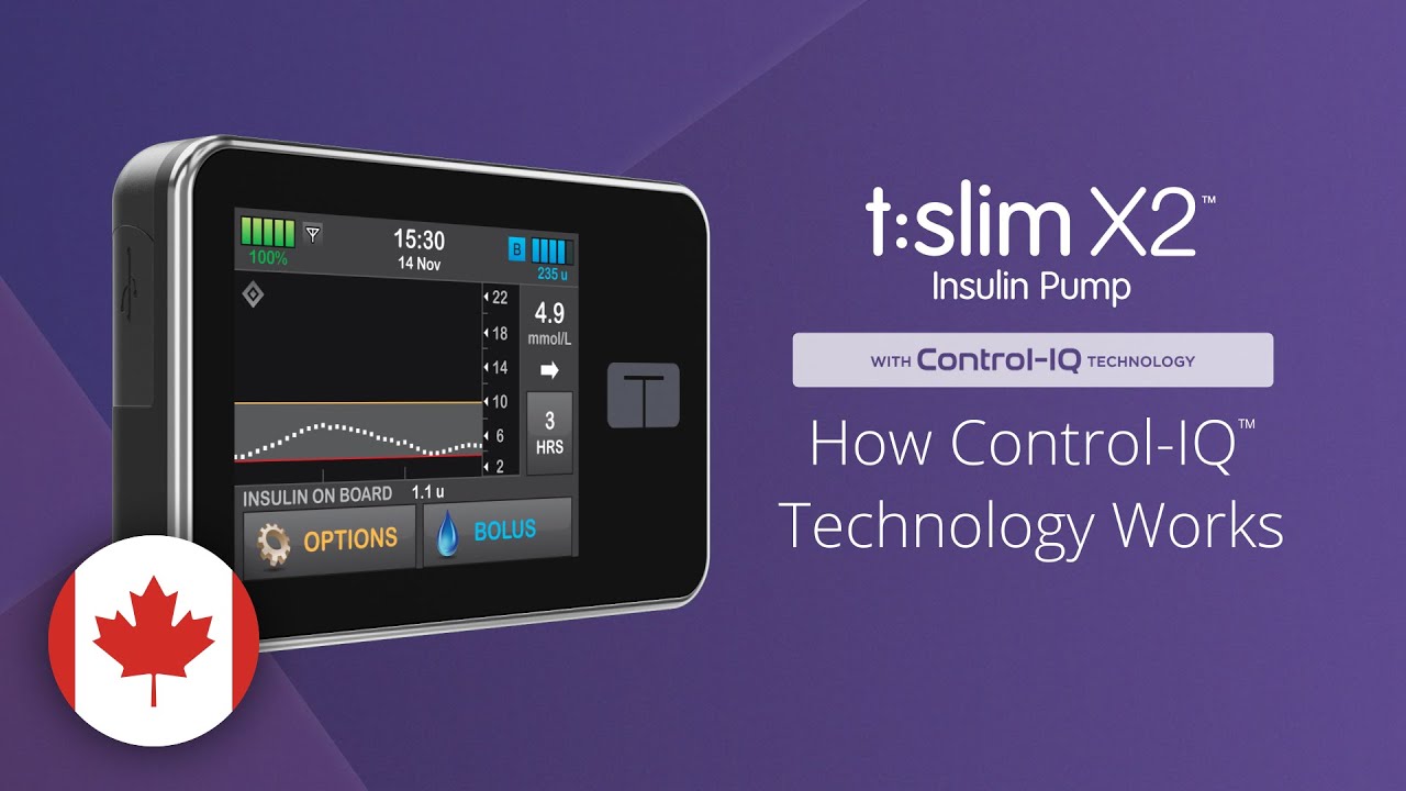 How Control-IQ Technology Works on the t:slim X2 Insulin Pump
