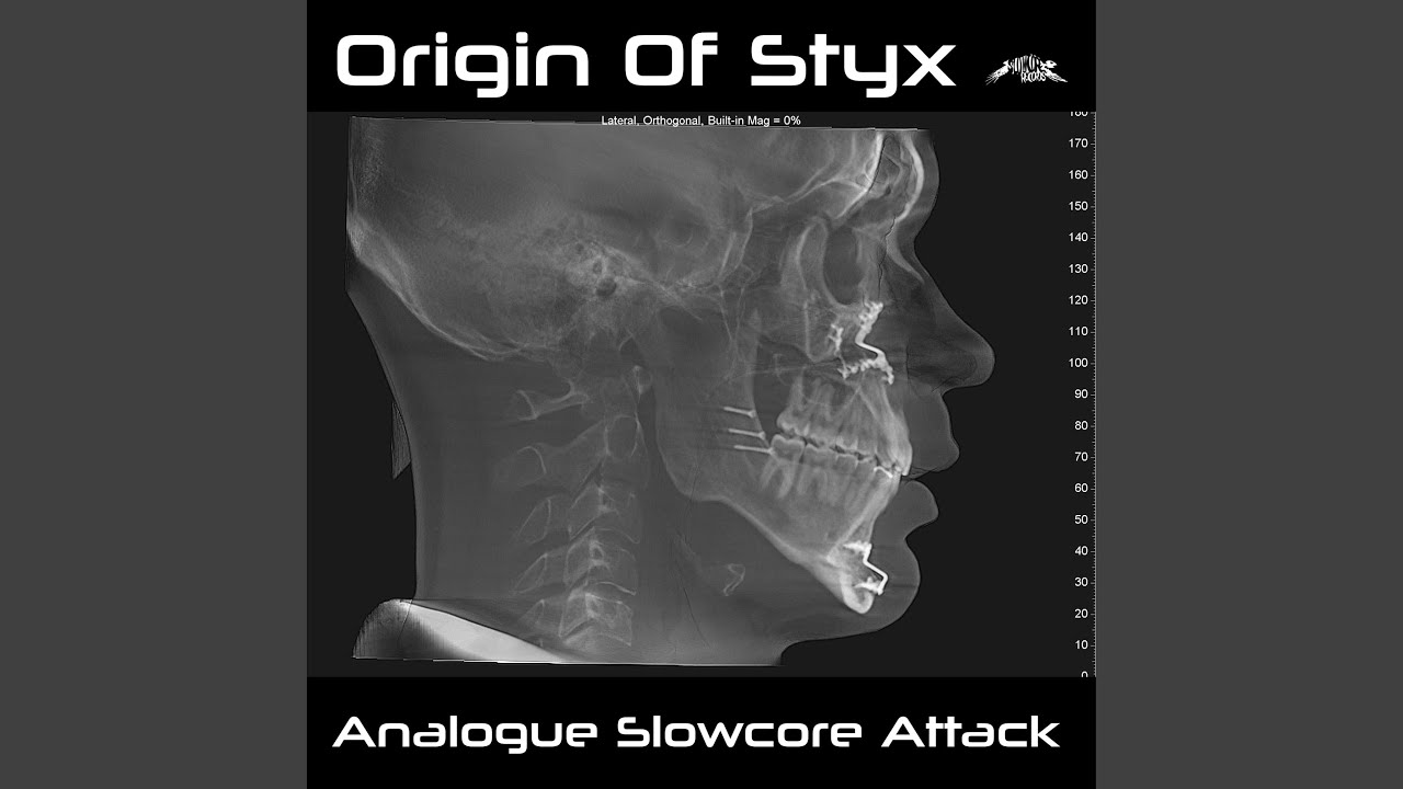 Mira Analogue Slowcore Attack en YouTube
