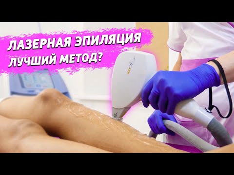 Шугаринг или Лазерная эпиляция - Плюсы и Минусы | МОЙ ОПЫТ удаления волос НАВСЕГДА!