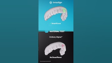 Think All Aligners Are the Same? Think Again.