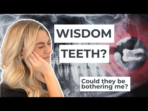 WISDOM TEETH: Is the pain from your wisdom teeth? Do you get them removed? 😬
