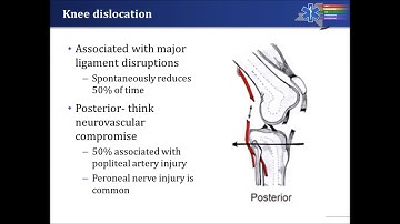 Patellar Dislocation Teaching Collaborative Final Video