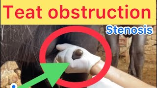 Teat Obstruction L Teat Fibrosis L Spider L Masis With Fibrosis L बद थन क इलजLdr Umar Khan