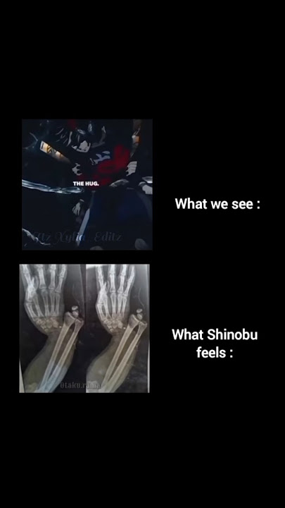 My poor Shinobu 😭😭#demonslayer#shinobu#douma#fypシ#sadmoment🕊️🕊️