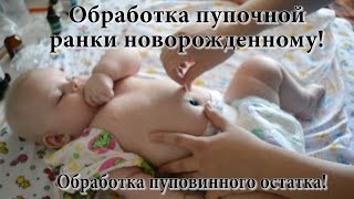 Обработка пупочной ранки новорожденному и пуповинного остатка! УЗНАЙТЕ АБСОЛЮТНО ВСЕ ЗА 12 МИНУТ!