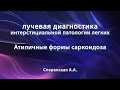 Сперанская А.А. – Атипичные формы саркоидоза