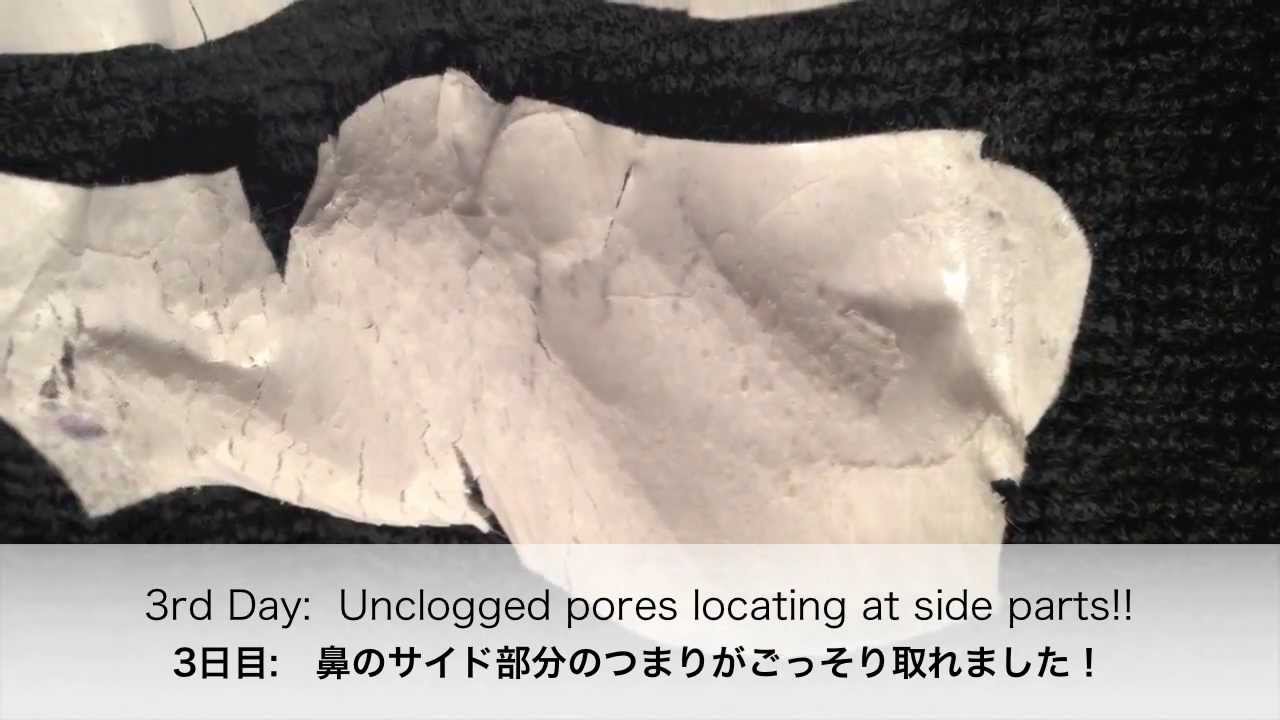 What if you use pore strips continuously 3 days? 3日連続で毛穴パック使ってみた YouTube