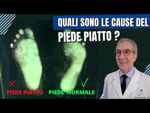 Video: Cos'è lo spostamento del piede piatto?