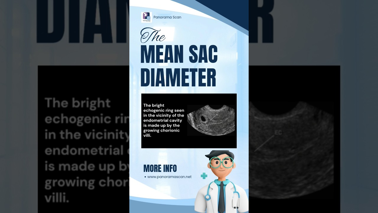 Как измерить средний диаметр околоплодного мешка (MSD) на УЗИ в первом триместре 