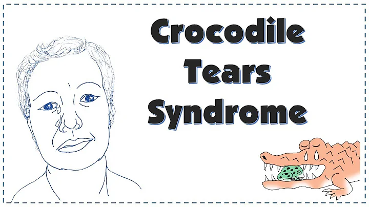 Crocodile Tears | Bogorad Syndrome| Explained