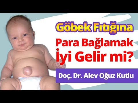 Video: Çocuklarda Göbek Fıtığı Nasıl Tedavi Edilir