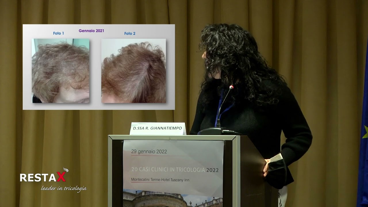 Caso Clinico N°18 Dr.ssa Rosa Giannatiempo -20 CASI CLINICI IN TRICOLOGIA 2022