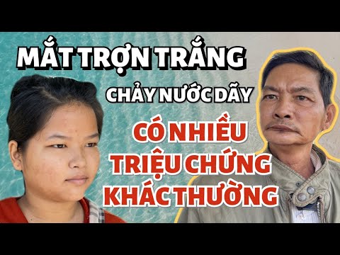 Ngày thứ 4 có nhiều biểu hiện lạ, 2 mắt trợn trắng bất thường cha ruột b.é Hương lo sợ đi tìm bác sĩ Ngày thứ 4 có nhiều biểu hiện lạ, 2 mắt trợn trắng bất thường cha ruột b.é Hương lo sợ đi tìm bác sĩ
