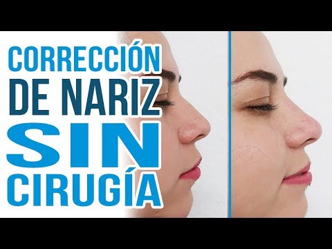 Video: Se Enumeran Formas De Cambiar La Forma De La Nariz Sin Cirugía
