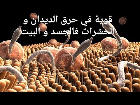 رقية قوية لحرق الديدان و الحشرات من شياطين خدام العين و الحسد و الأسحار رقية قوية لحرق الديدان و الحشرات من شياطين خدام العين و الحسد و الأسحار