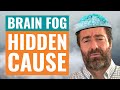 The Hidden Reason You Have Brain Fog