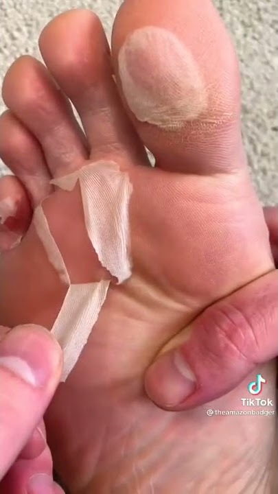 Foot Peel Mask || TIKTOK HACK || #shorts