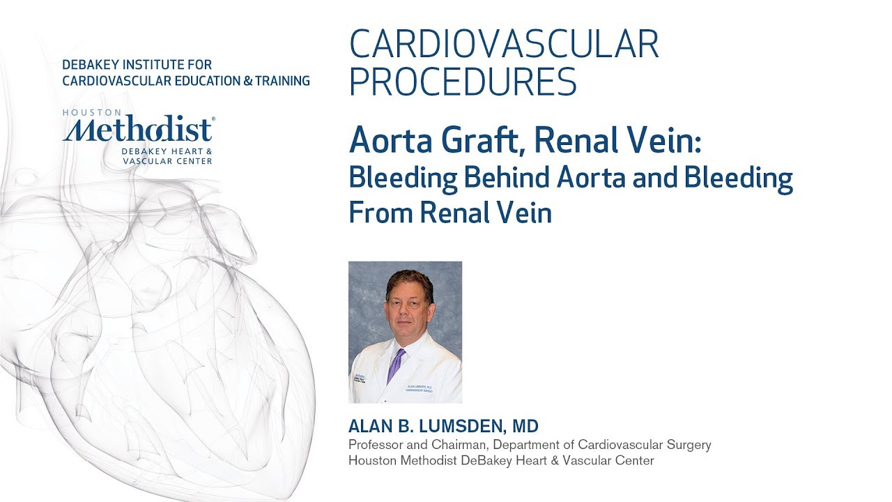 Aorta Graft, Renal Vein (ALAN B. LUMSDEN, MD) education film