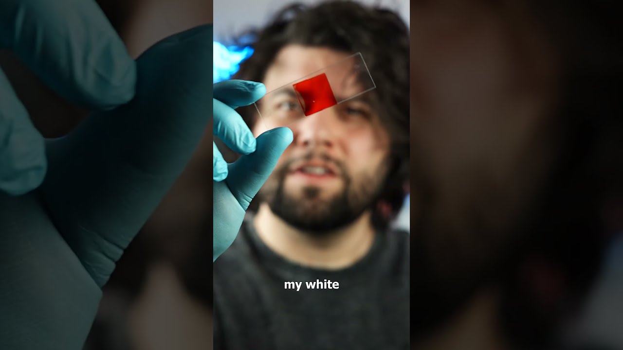 White Blood Cell VS Still Water Microbes 