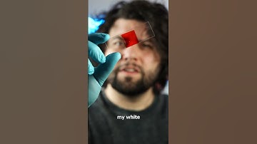 White Blood Cell VS Still Water Microbes!