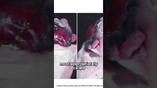 USMLE Step 1 High Yield | First Aid Rapid Review Facts You Must Know