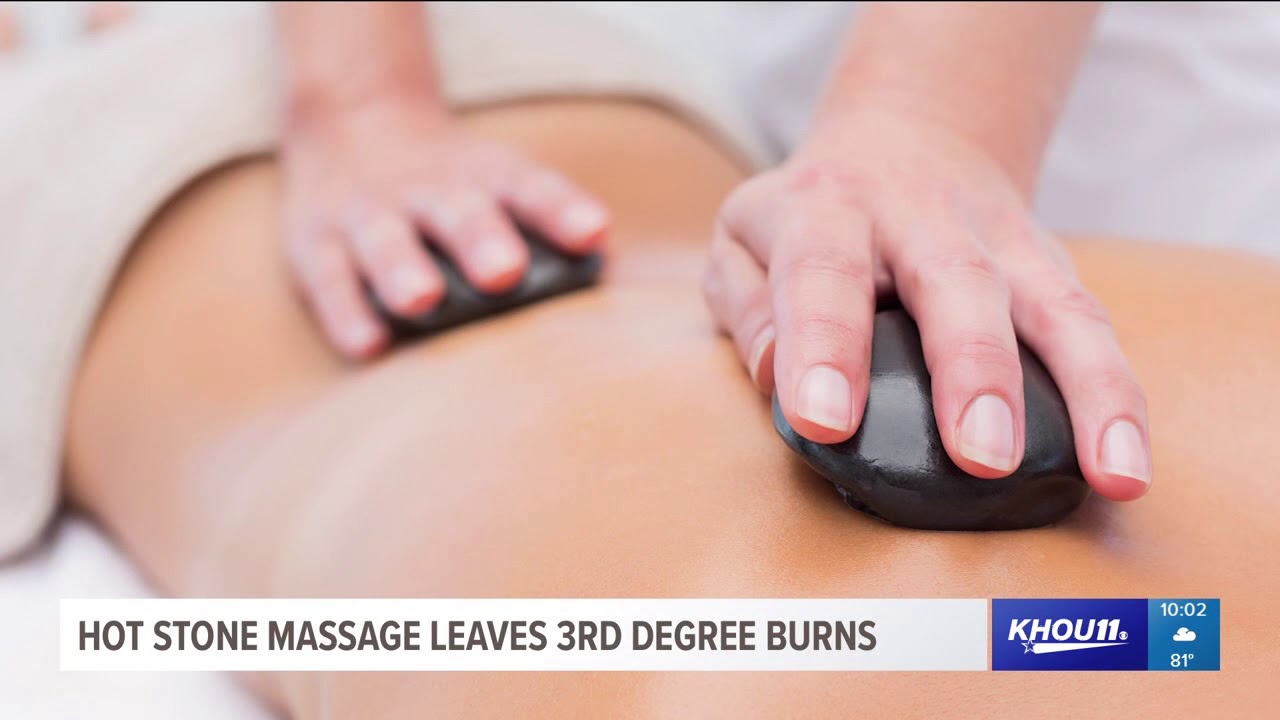 Hot Stone Massage Leaves Third Degree Burns Youtube