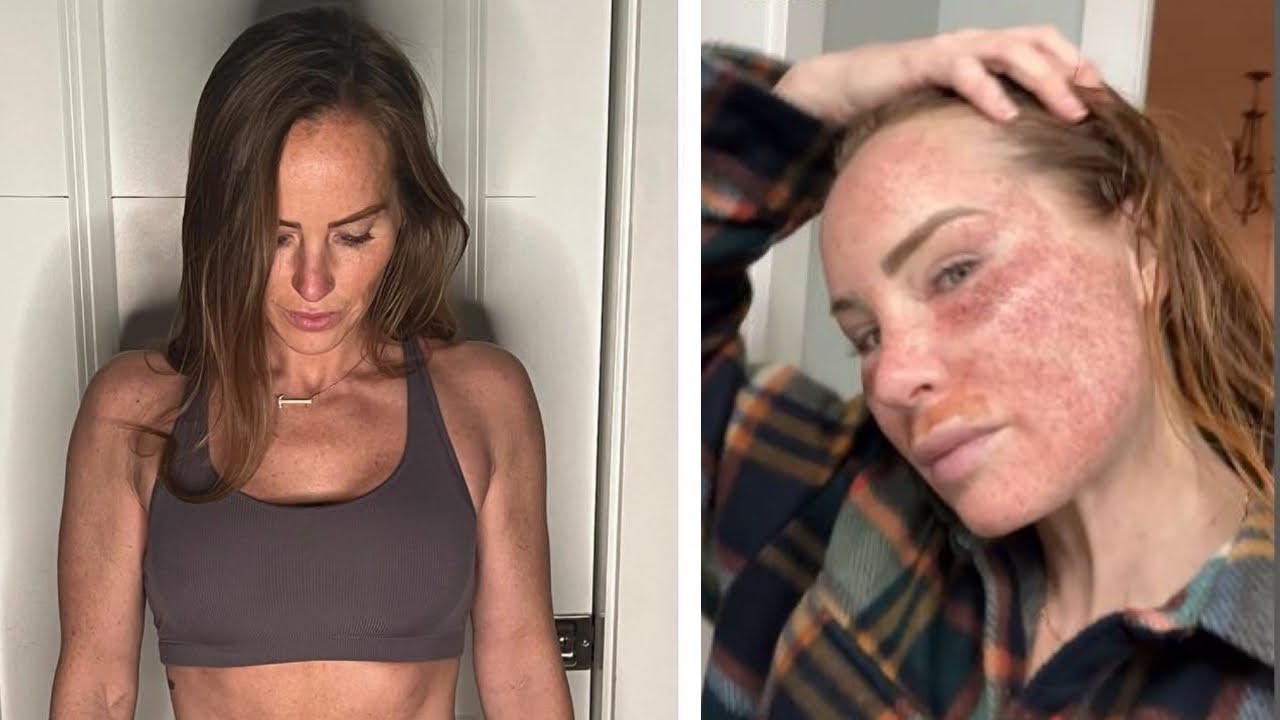 What happened to Mina Starsiak's face? Fans are really concerned YouTube