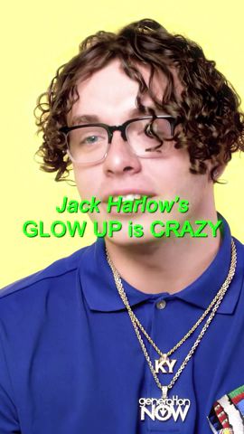 Jack Harlow's Glow Up is CRAZY 😳✨