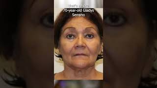Long Island woman charged with practicing unlicensed dentistry out of apartment kitchen | News 12