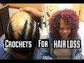 CROCHETS FOR HAIR LOSS CLIENTS