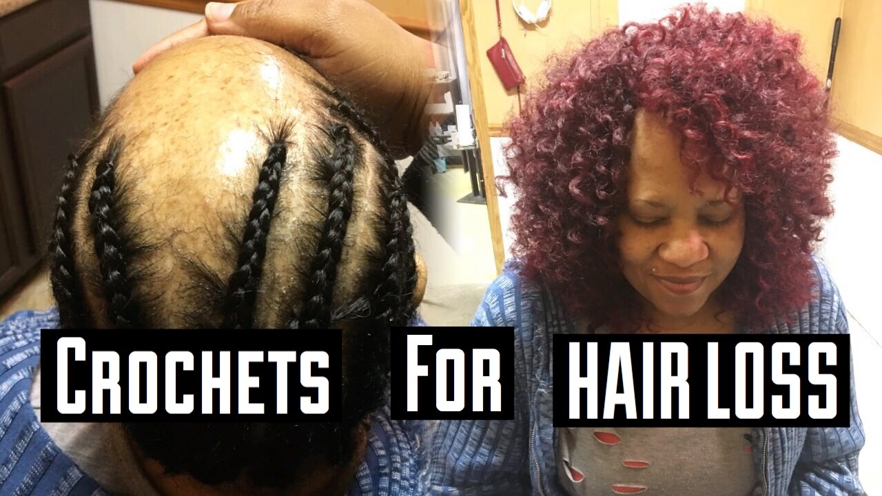 CROCHETS FOR HAIR LOSS CLIENTS - YouTube