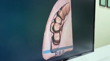 UP360+ Uncut model True Color Scan