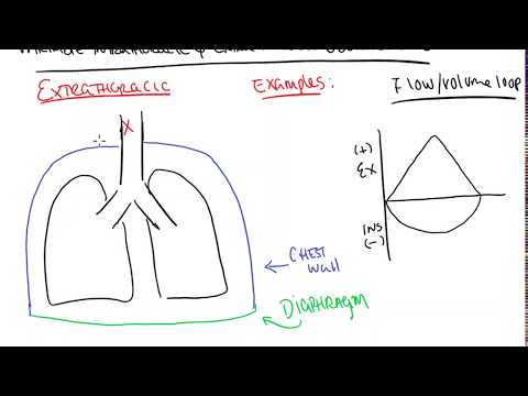 Variable Intra And Extra Thoracic Obstructions 