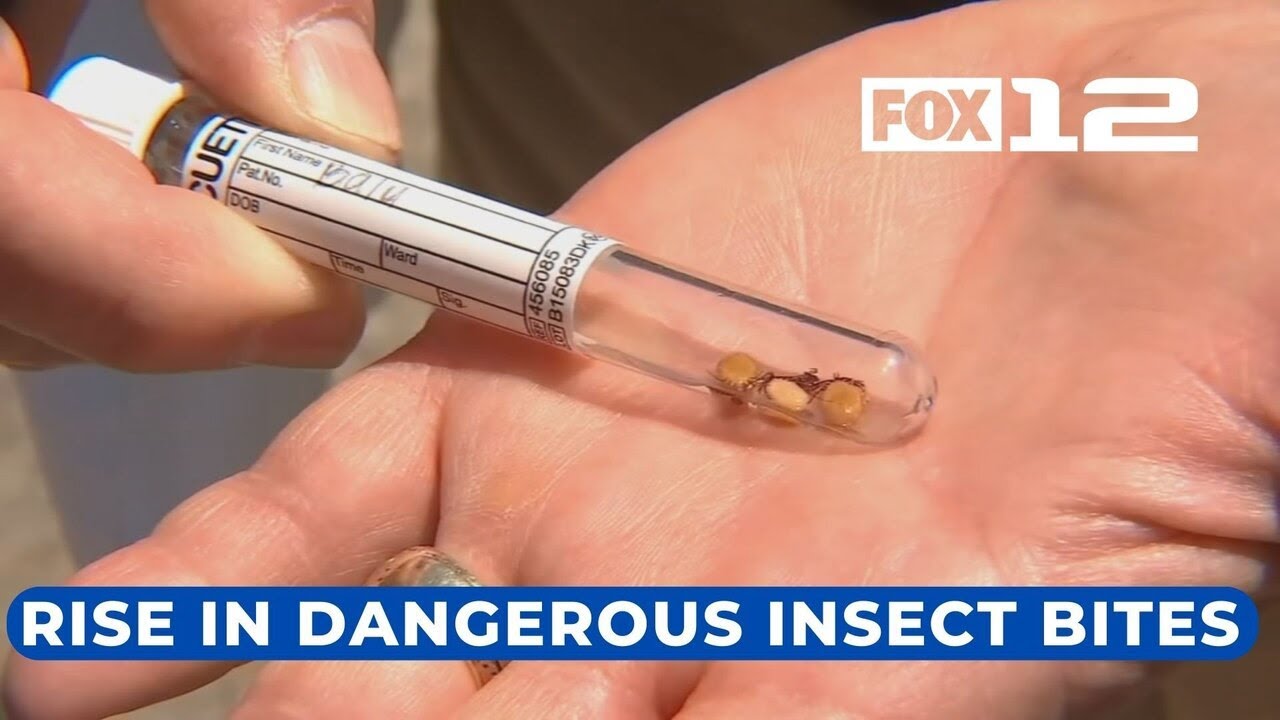 Doctors see more patients with insect bites in Oregon, warn against risk of disease from insects
