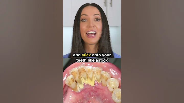 dental tartar vs dental plaque #shorts