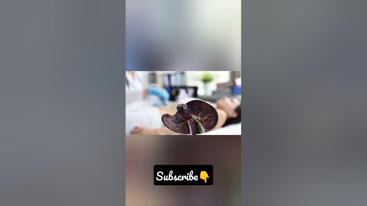 Vitamin B12 Deficiency5 jaundice symptoms deficiency vitamin b12 