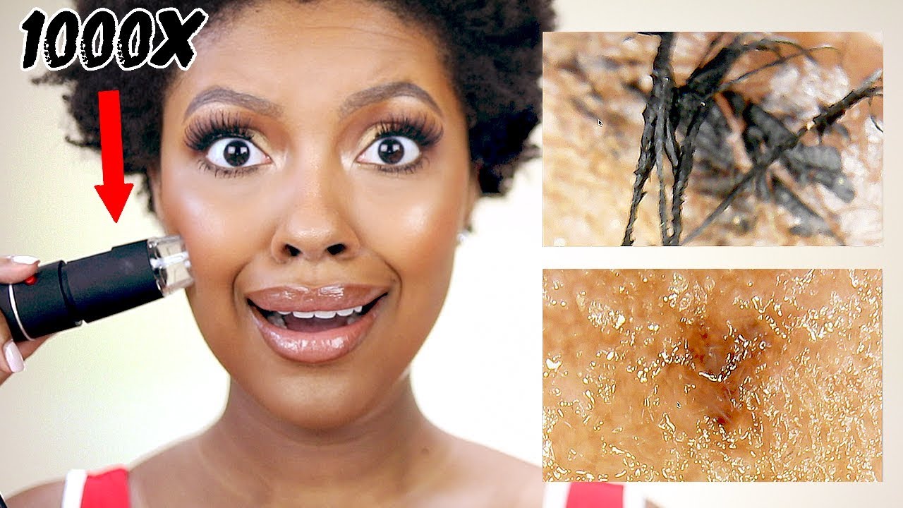 MY SKIN UNDER A MICROSCOPE OMGGG YouTube