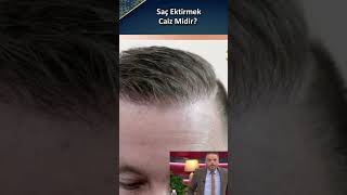 Saç Ektirmek Caiz Midir?