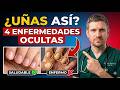 Neurólogo advierte: si tus uñas se ven así después de los 60, podrían ocultar 4 enfermedades