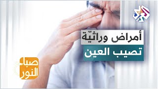 التهاب الشبكية الصباغي .. أمراض تصيب العين وقد تكون وراثيّة