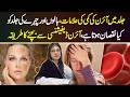 Iron Deficiency Signs on Skin - Body aur Skin par Iron ki Kami ke Nishan or ilaj