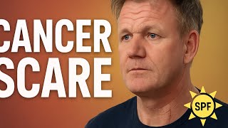 Famous Gordon Ramsay Reveals Skin Cancer Scare: His Powerful Warning. Net Worth