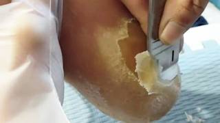 How to get a clean foot?