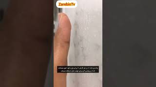 تشنگی پشه‌ها برای خون خواری